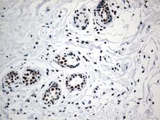 GTF3C4 Antibody - Immunohistochemical staining of paraffin-embedded Human breast tissue within the normal limits using anti-GTF3C4 mouse monoclonal antibody. (Heat-induced epitope retrieval by 1mM EDTA in 10mM Tris buffer. (pH8.5) at 120°C for 3 min. (1:750)