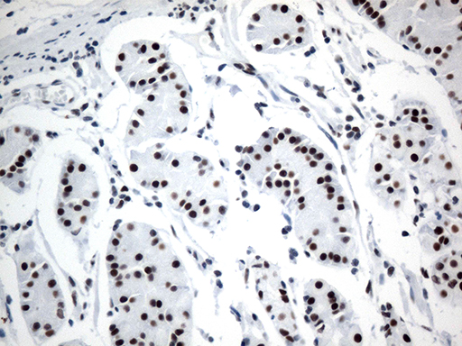 GTF3C4 Antibody - Immunohistochemical staining of paraffin-embedded Human gastric tissue within the normal limits using anti-GTF3C4 mouse monoclonal antibody. (Heat-induced epitope retrieval by 1mM EDTA in 10mM Tris buffer. (pH8.5) at 120°C for 3 min. (1:750)