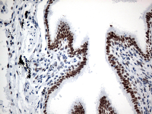 GTF3C4 Antibody - Immunohistochemical staining of paraffin-embedded Human lung tissue within the normal limits using anti-GTF3C4 mouse monoclonal antibody. (Heat-induced epitope retrieval by 1mM EDTA in 10mM Tris buffer. (pH8.5) at 120°C for 3 min. (1:750)