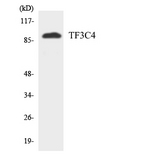 GTF3C4 Antibody - Western blot analysis of the lysates from HUVECcells using TF3C4 antibody.