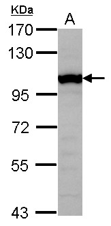 GTF3C4 Antibody - Sample (30 ug of whole cell lysate) A: U87-MG 7.5% SDS PAGE GTF3C4 antibody diluted at 1:1000