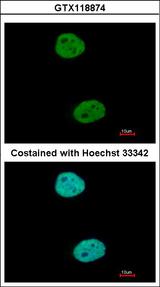 GTF3C4 Antibody - Immunofluorescence of paraformaldehyde-fixed HeLa, using GTF3C4 antibody at 1:500 dilution.