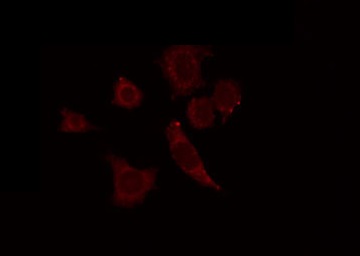 GTF3C4 Antibody - Staining RAW264.7 cells by IF/ICC. The samples were fixed with PFA and permeabilized in 0.1% Triton X-100, then blocked in 10% serum for 45 min at 25°C. The primary antibody was diluted at 1:200 and incubated with the sample for 1 hour at 37°C. An Alexa Fluor 594 conjugated goat anti-rabbit IgG (H+L) Ab, diluted at 1/600, was used as the secondary antibody.