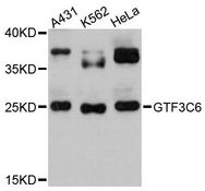 GTF3C6 Antibody - Western blot analysis of extracts of various cell lines, using GTF3C6 antibody at 1:3000 dilution. The secondary antibody used was an HRP Goat Anti-Rabbit IgG (H+L) at 1:10000 dilution. Lysates were loaded 25ug per lane and 3% nonfat dry milk in TBST was used for blocking. An ECL Kit was used for detection and the exposure time was 90s.