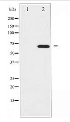GTPase Activating Protein (GAP) Antibody - Western blot of GTPase Activating Protein expression in COS7 whole cell lysates,The lane on the left is treated with the antigen-specific peptide.