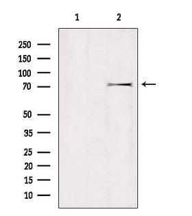 GTPBP1 / GP1 Antibody - Western blot analysis of extracts of mouse brain tissue using GTPBP1 antibody. Lane 1 was treated with the blocking peptide.