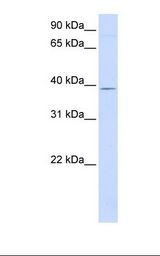 GTPBP10 Antibody - 721_B cell lysate. Antibody concentration: 1.0 ug/ml. Gel concentration: 12%.  This image was taken for the unconjugated form of this product. Other forms have not been tested.