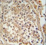 GTPBP2 Antibody - GTPBP2 antibody immunohistochemistry of formalin-fixed and paraffin-embedded human testis tissue followed by peroxidase-conjugated secondary antibody and DAB staining.