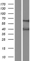 GTPBP3 Protein - Western validation with an anti-DDK antibody * L: Control HEK293 lysate R: Over-expression lysate