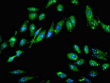GTPBP4 Antibody - Immunofluorescent analysis of Hela cells at a dilution of 1:100 and Alexa Fluor 488-congugated AffiniPure Goat Anti-Rabbit IgG(H+L)