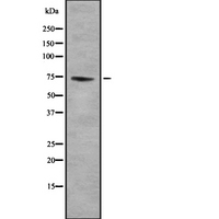 GTPBP4 Antibody - Western blot analysis of GTPBP4 using COLO205 whole lysates.