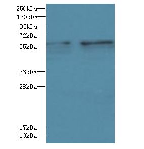 GTPBP6 Antibody - Western blot. All lanes: GTPBP6 antibody at 6 ug/ml. Lane 1: A549 whole cell lysate. Lane 2: HeLa whole cell lysate. Secondary Goat polyclonal to Rabbit IgG at 1:10000 dilution. Predicted band size: 57 kDa. Observed band size: 57 kDa.