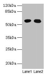 GTPBP6 Antibody - Western blot All lanes: GTPBP6 antibody at 6µg/ml Lane 1: A549 whole cell lysate Lane 2: Hela whole cell lysate Secondary Goat polyclonal to rabbit IgG at 1/10000 dilution Predicted band size: 57 kDa Observed band size: 57 kDa