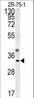 GTPCH1 / GCH1 Antibody - GCH1 Antibody western blot of ZR-75-1 cell line lysates (35 ug/lane). The GCH1 antibody detected the GCH1 protein (arrow).