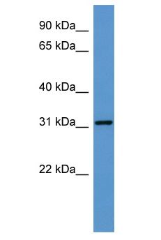 GTPCH1 / GCH1 Antibody - GTPCH1 / GCH1 antibody Western Blot of Fetal Heart. Antibody dilution: 1 ug/ml.  This image was taken for the unconjugated form of this product. Other forms have not been tested.