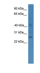 GTPCH1 / GCH1 Antibody - GCH1 antibody Western blot of COLO205 cell lysate.  This image was taken for the unconjugated form of this product. Other forms have not been tested.