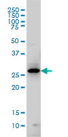 GTPCH1 / GCH1 Antibody - GCH1 monoclonal antibody (M01), clone 4A12 Western blot of GCH1 expression in IMR-32.