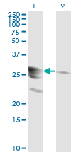 GTPCH1 / GCH1 Antibody - Western blot of GCH1 expression in transfected 293T cell line by GCH1 monoclonal antibody (M01), clone 4A12.