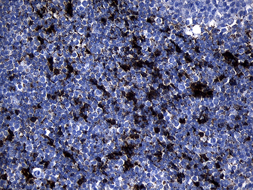 GTPCH1 / GCH1 Antibody - Immunohistochemical staining of paraffin-embedded Human tonsil within the normal limits using anti-GCH1 mouse monoclonal antibody. (Heat-induced epitope retrieval by 1mM EDTA in 10mM Tris buffer. (pH8.5) at 120°C for 3 min. (1:500)