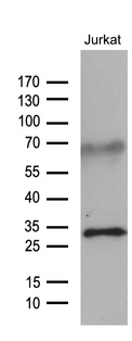 GTPCH1 / GCH1 Antibody - Western blot analysis of extracts. (35ug) from Jurkat cell line by using anti-GCH1 monoclonal antibody. (1:500)