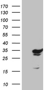 GTPCH1 / GCH1 Antibody - HEK293T cells were transfected with the pCMV6-ENTRY control. (Left lane) or pCMV6-ENTRY GCH1. (Right lane) cDNA for 48 hrs and lysed