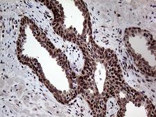 GTPCH1 / GCH1 Antibody - Immunohistochemical staining of paraffin-embedded Human skin tissue within the normal limits using anti-GCH1 mouse monoclonal antibody. (Heat-induced epitope retrieval by 1mM EDTA in 10mM Tris buffer. (pH8.5) at 120 oC for 3 min. (1:500)