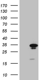 GTPCH1 / GCH1 Antibody - HEK293T cells were transfected with the pCMV6-ENTRY control. (Left lane) or pCMV6-ENTRY GCH1. (Right lane) cDNA for 48 hrs and lysed. Equivalent amounts of cell lysates. (5 ug per lane) were separated by SDS-PAGE and immunoblotted with anti-GCH1. (1:2000)