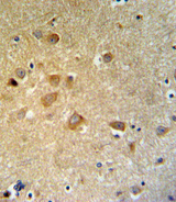 GTSE1 Antibody - GTSE1 Antibody IHC of formalin-fixed and paraffin-embedded brain tissue followed by peroxidase-conjugated secondary antibody and DAB staining.