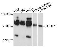 GTSE1 Antibody - Western blot analysis of extracts of various cell lines, using GTSE1 antibody at 1:3000 dilution. The secondary antibody used was an HRP Goat Anti-Rabbit IgG (H+L) at 1:10000 dilution. Lysates were loaded 25ug per lane and 3% nonfat dry milk in TBST was used for blocking. An ECL Kit was used for detection and the exposure time was 30s.