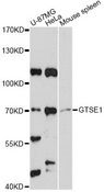 GTSE1 Antibody - Western blot analysis of extracts of various cell lines, using GTSE1 antibody at 1:3000 dilution. The secondary antibody used was an HRP Goat Anti-Rabbit IgG (H+L) at 1:10000 dilution. Lysates were loaded 25ug per lane and 3% nonfat dry milk in TBST was used for blocking. An ECL Kit was used for detection and the exposure time was 90s.