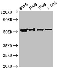 Guanine nucleotide-binding protein subunit beta-like protein Antibody - Western Blot Positive WB detected in Recombinant protein All lanes: Guanine antibody at 2.8µg/ml Secondary Goat polyclonal to rabbit IgG at 1/50000 dilution predicted band size: 52 kDa observed band size: 52 kDa