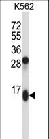 GUCA2A / Guanylin Antibody - GUCA2A Antibody western blot of K562 cell line lysates (35 ug/lane). The GUCA2A antibody detected the GUCA2A protein (arrow).