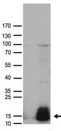 GUCA2A / Guanylin Antibody - HEK293T cells were transfected with the pCMV6-ENTRY control. (Left lane) or pCMV6-ENTRY GUCA2A. (Right lane) cDNA for 48 hrs and lysed