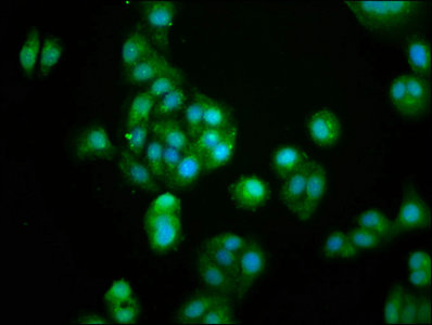 GUCA2B / Uroguanylin Antibody - Immunofluorescence staining of HepG2 cells with GUCA2B Antibody at 1:100, counter-stained with DAPI. The cells were fixed in 4% formaldehyde, permeabilized using 0.2% Triton X-100 and blocked in 10% normal Goat Serum. The cells were then incubated with the antibody overnight at 4°C. The secondary antibody was Alexa Fluor 488-congugated AffiniPure Goat Anti-Rabbit IgG(H+L).