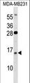 GUCA2B / Uroguanylin Antibody - GUCA2B Antibody western blot of MDA-MB231 cell line lysates (35 ug/lane). The GUCA2B antibody detected the GUCA2B protein (arrow).