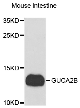 GUCA2B / Uroguanylin Antibody - Western blot analysis of extracts of Mouse intestine cells.