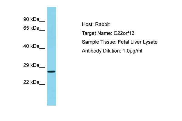 GUCD1 Antibody -  This image was taken for the unconjugated form of this product. Other forms have not been tested.