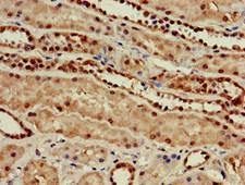 GUCD1 Antibody - Immunohistochemistry of paraffin-embedded human kidney tissue at dilution of 1:100