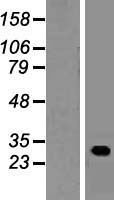 GUCD1 Protein - Western validation with an anti-DDK antibody * L: Control HEK293 lysate R: Over-expression lysate