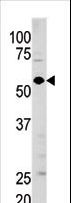 GUCY1A1 / GUCY1A3 Antibody - Western blot of anti-GUCY1A3 antibody in mouse brain tissue lysate (35 ug/lane). GUCY1A3(arrow) was detected using the purified antibody.