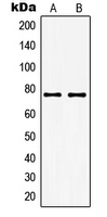 GUCY1A1 / GUCY1A3 Antibody - Western blot analysis of GUCY1A3 expression in THP1 (A); KNRK (B) whole cell lysates.