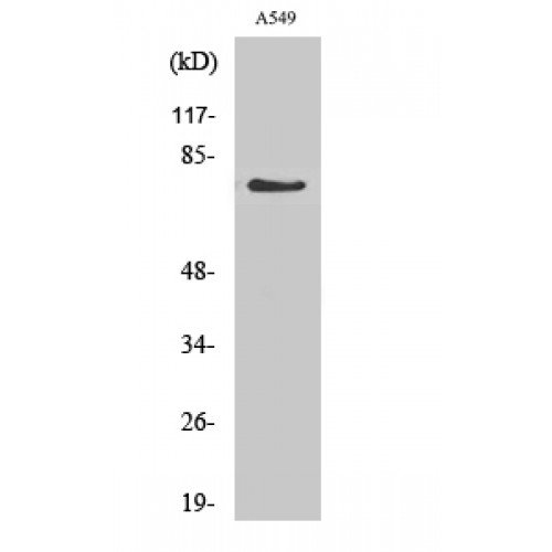 GUCY1A1 / GUCY1A3 Antibody - Western blot of GCS-alpha-1 antibody