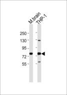GUCY1A1 / GUCY1A3 Antibody - All lanes : Anti-GUCY1A3 Antibody at 1:1000 dilution Lane 1: M.brain tissue lysates Lane 2: THP-1 whole cell lysates Lysates/proteins at 20 ug per lane. Secondary Goat Anti-Rabbit IgG, (H+L),Peroxidase conjugated at 1/10000 dilution Predicted band size : 77 kDa Blocking/Dilution buffer: 5% NFDM/TBST.