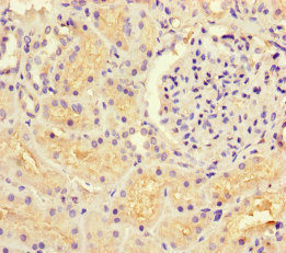 GUCY1A1 / GUCY1A3 Antibody - Immunohistochemistry of paraffin-embedded human kidney tissue at dilution of 1:100