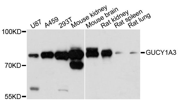 GUCY1A1 / GUCY1A3 Antibody - Western blot analysis of extracts of various cell lines, using GUCY1A3 antibody at 1:3000 dilution. The secondary antibody used was an HRP Goat Anti-Rabbit IgG (H+L) at 1:10000 dilution. Lysates were loaded 25ug per lane and 3% nonfat dry milk in TBST was used for blocking. An ECL Kit was used for detection and the exposure time was 90s.