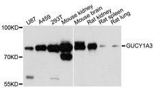 GUCY1A1 / GUCY1A3 Antibody - Western blot analysis of extracts of various cell lines, using GUCY1A3 antibody at 1:3000 dilution. The secondary antibody used was an HRP Goat Anti-Rabbit IgG (H+L) at 1:10000 dilution. Lysates were loaded 25ug per lane and 3% nonfat dry milk in TBST was used for blocking. An ECL Kit was used for detection and the exposure time was 90s.
