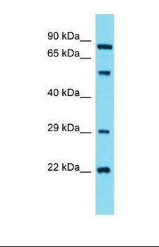 GUCY1A2 Antibody - Western blot of Human HepG2. GUCY1A2 antibody dilution 1.0 ug/ml.  This image was taken for the unconjugated form of this product. Other forms have not been tested.