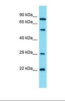 GUCY1A2 Antibody - Western blot of Human HepG2. GUCY1A2 antibody dilution 1.0 ug/ml.  This image was taken for the unconjugated form of this product. Other forms have not been tested.