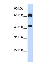 GUCY1B3 Antibody - GUCY1B3 / Guanylyl Cyclase Beta 1 antibody Western blot of 293T cell lysate. This image was taken for the unconjugated form of this product. Other forms have not been tested.