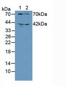 GUCY1B3 Antibody - Western Blot; Sample: Lane1: Human Blood Platelet Cells; Lane2: Rat Brain Tissue.